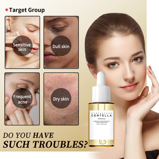 Centella Asiatica Brightening Serum – Calming, Acne Care & Dark Spot Repair