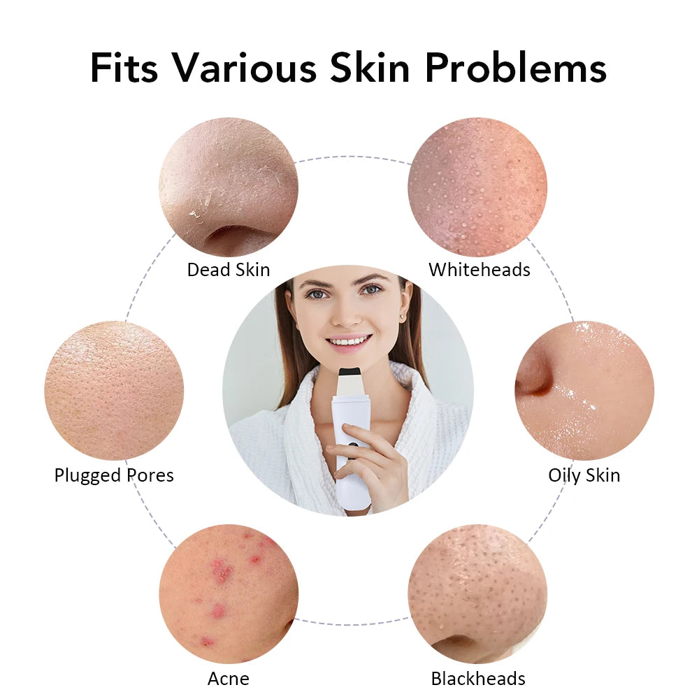 Ultrasonic Skin Scrubber – 4 Mode Facial Deep Cleansing & Lifting Device