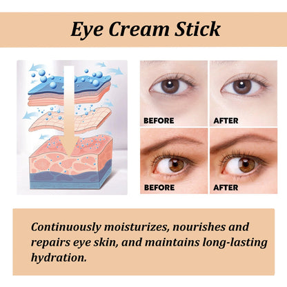 Snail Mucin Eye Cream Stick – Anti-Wrinkle, Dark Circle & Eye Bag Remover