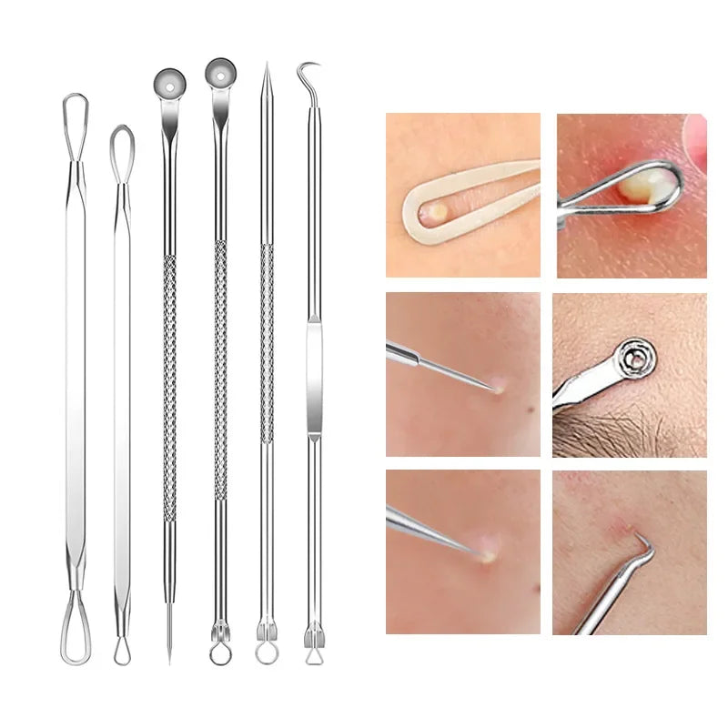 4–11PCS Blackhead Removal Tool Kit – Tweezers & Acne Needle Set