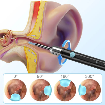 WiFi Endoscope 4.2mm 1080P Ear Picker Camera with Ear Spoon Base for iOS/Android Ear Cleaning Otoscope with Ear Wax Removal Tool