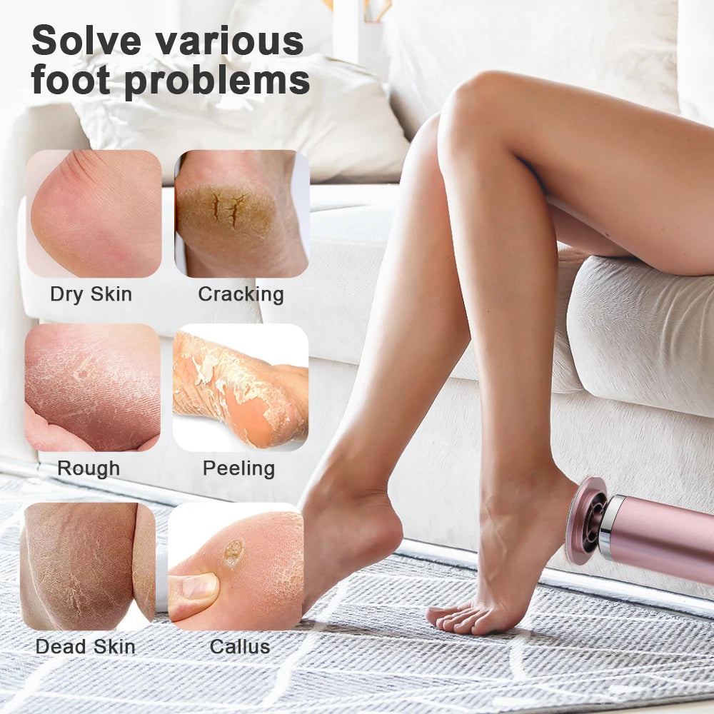 Wireless Electric Foot Callus Remover Machine Rechargeable Pedicure Tool for Dead Skin And Cuticle Removal with Replacement Sand