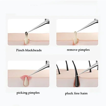 4–11PCS Blackhead Removal Tool Kit – Tweezers & Acne Needle Set