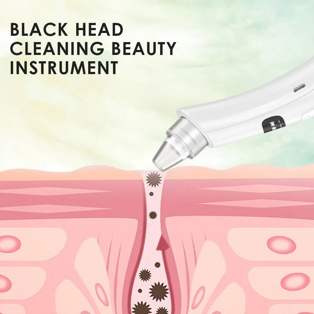 Blackhead Remover Vacuum – 3 Suction Modes Face Cleansing Device