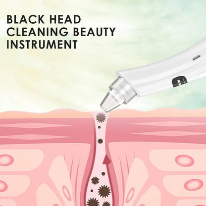 Blackhead Remover Vacuum – 3 Suction Modes Face Cleansing Device