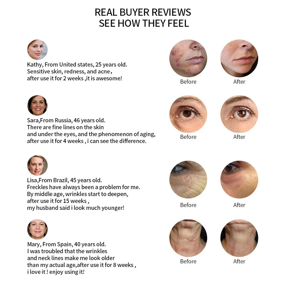 Face Lifting Machine EMS Micro-current Facial Skin Firm Massager LED Photon Rejuvenation Beauty Device