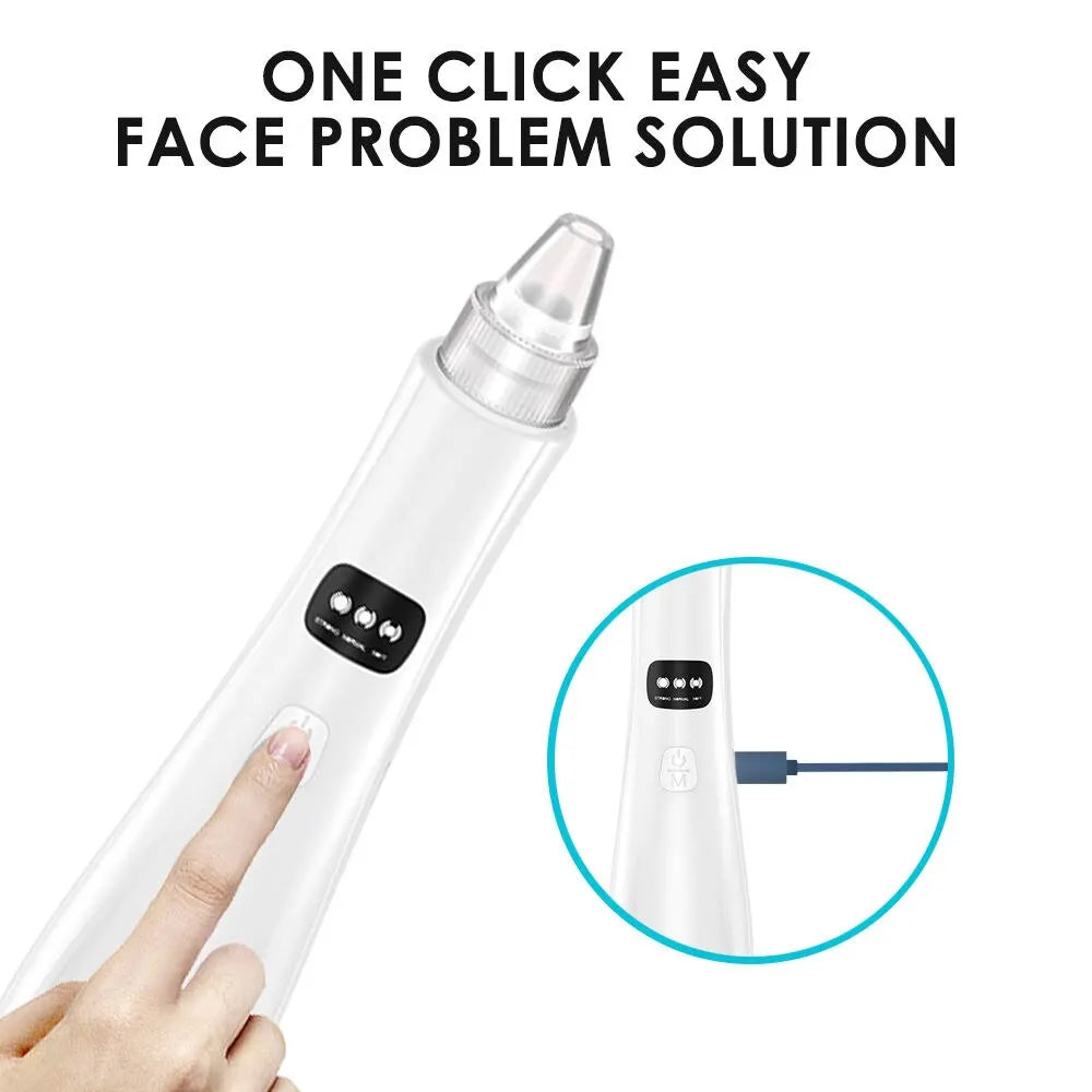 Blackhead Remover Vacuum – 3 Suction Modes Face Cleansing Device