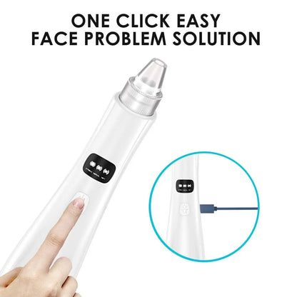 Blackhead Remover Vacuum – 3 Suction Modes Face Cleansing Device