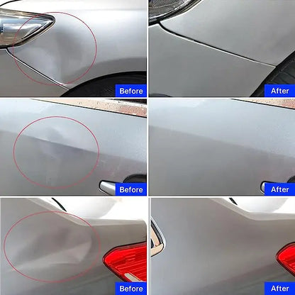 Paintless Dent Repair Puller Kit with Suction Cups for Car Body Repair