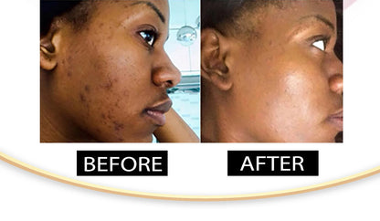 AILKE Brightening Cream – Dark Spot & Even Tone Moisturizer for Face & Body with Collagen