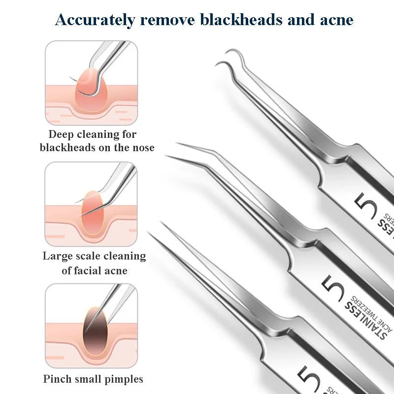 4–11PCS Blackhead Removal Tool Kit – Tweezers & Acne Needle Set